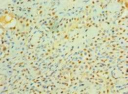 LIMK2 Antibody (aa1-240)