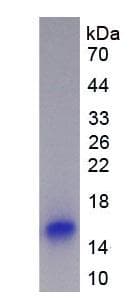 Human PTN / Pleiotrophin Protein (Recombinant His, N-Terminal)