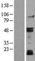 MAPK10 / JNK3 Protein (Over-Expression Lysate Myc-DDK (Flag))
