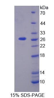 Human HIPK2 Protein (Recombinant His-T7)