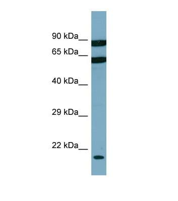DESI2 / PPPDE1 Antibody (C-Terminus)