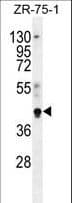 PYGO1 / Pygopus 1 Antibody (aa382-409)