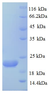 Human CASP8 / Caspase 8 Protein (Recombinant His)