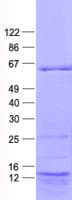 Human E2F3 Protein (Recombinant His, N-Terminal)