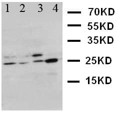 BCL10 / BCL-10 Antibody (aa35-51)