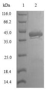 Human TAC1 Protein (Recombinant GST, N-terminus)