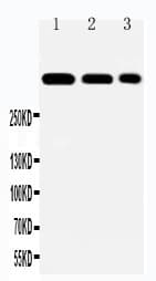 LAMA2 / Merosin Antibody (aa152-170)