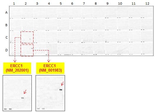 ERCC1 Antibody (clone 4F9)