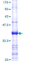 Human CCND3 / Cyclin D3 Protein (Recombinant GST, N-terminus)