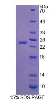 Rat APOB / Apolipoprotein B (Recombinant His)
