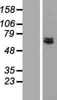 HSPC167 / CDK5RAP1 Protein (Over-Expression Lysate Myc-DDK (Flag))