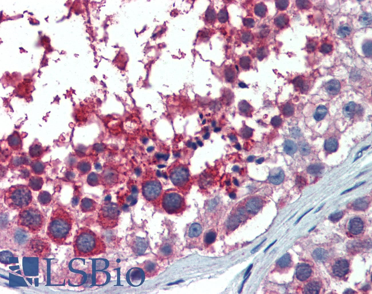 IHC-plus™ Monoclonal Mouse anti-Human US01 / p115 Antibody (clone 3F4, IHC, WB)