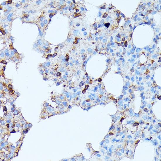 Polyclonal Rabbit anti-Human CXCR1 Antibody (IHC, WB)