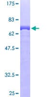Human ENO2 / NSE Protein (Recombinant GST)