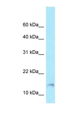 BAD Antibody (aa65-114)