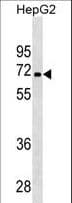 PDK3 Antibody