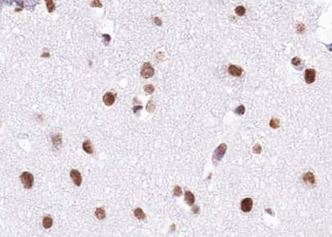 Polyclonal Rabbit anti-Human BRD7 Antibody (IHC, IF, WB)