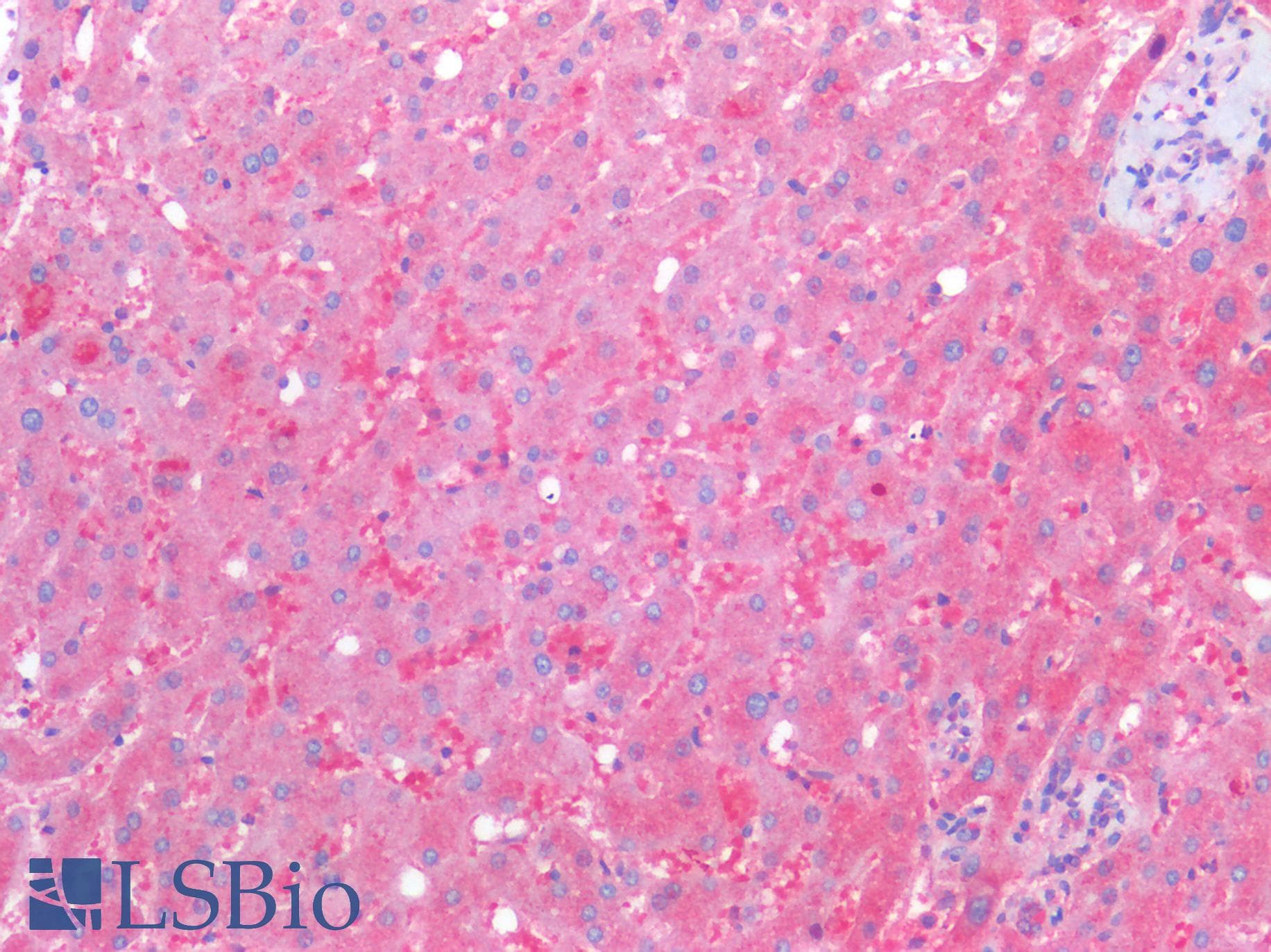 PathPlus™ Polyclonal Rabbit anti-Human SERPINA1 / Alpha 1 Antitrypsin Antibody (C-Terminus, IHC, WB)