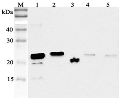 Polyclonal Guinea pig anti-Human RBP4 Antibody (WB)