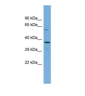 SHFM3 / FBXW4 Antibody (aa32-81)