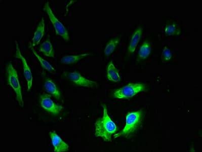 Polyclonal Rabbit anti-Human AP2S1 Antibody (IHC, WB)