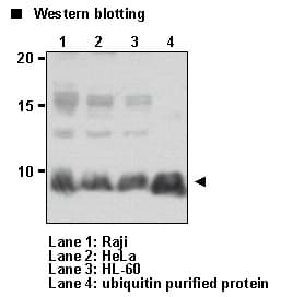 Ubiquitin Antibody (clone 2C5)
