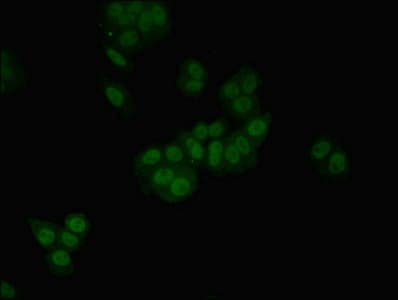 Polyclonal Rabbit anti-Human HGD Antibody (IHC, IF)