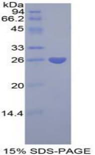Human PTX3 / Pentraxin 3 Protein (Recombinant His-T7)