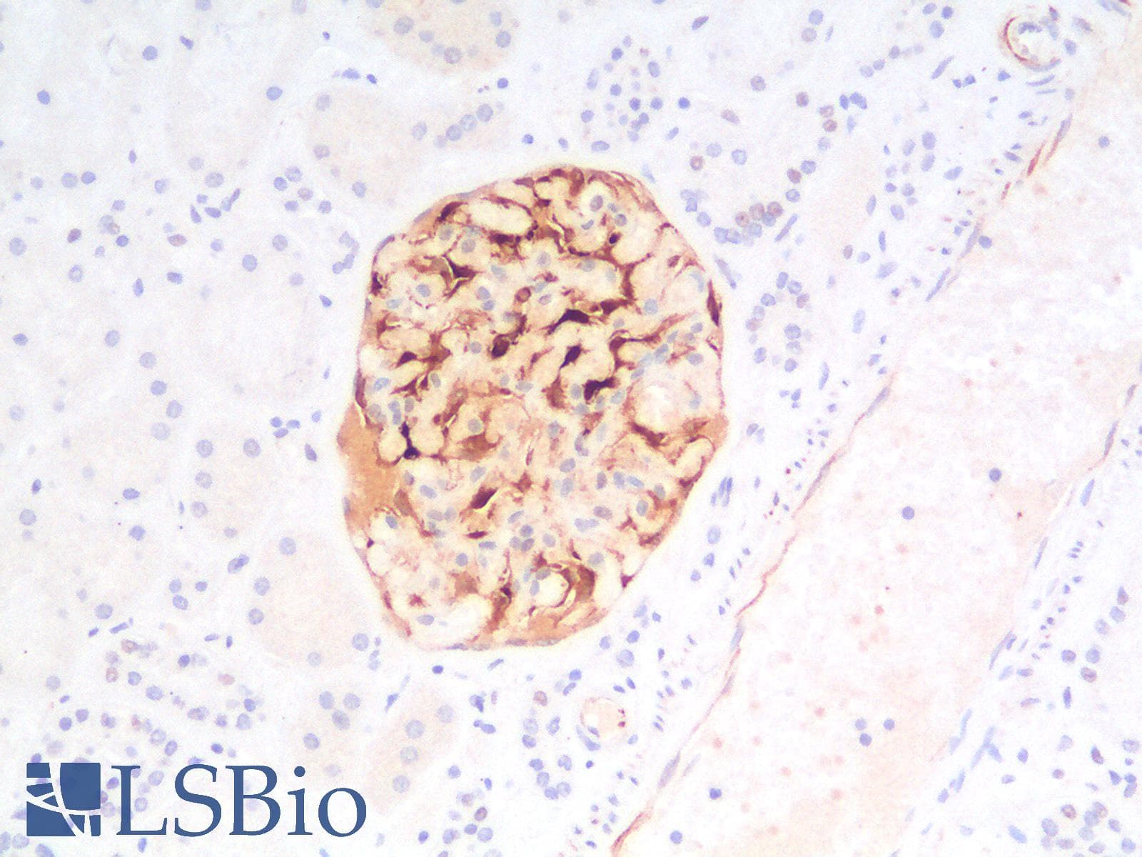 IHC-plus™ WT1 / Wilms Tumor 1 Antibody (clone rWT1/857)