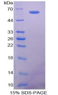 Human SPP1 / Osteopontin Protein (Recombinant His-GST)
