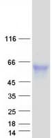 Human CD121b / IL1R2 Protein (Recombinant Myc-DDK (Flag))
