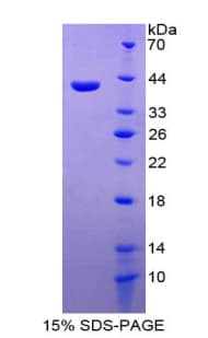 Human CCL26 / Eotaxin 3 Protein (Recombinant His-GST)