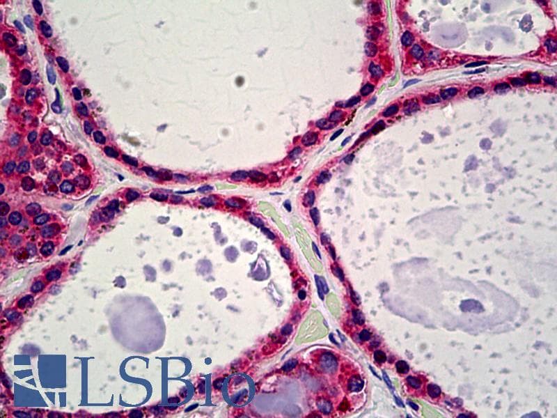 PathPlus™ CALR / Calreticulin Antibody