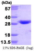 Human GSTT1 Protein (Recombinant His)