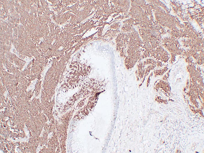 NCAM / CD56 Antibody (clone ABT-CD56)