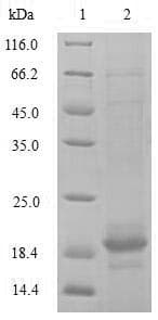 Rat TGFBR2 Protein (Recombinant 10His, N-terminus + Myc, C-terminus)