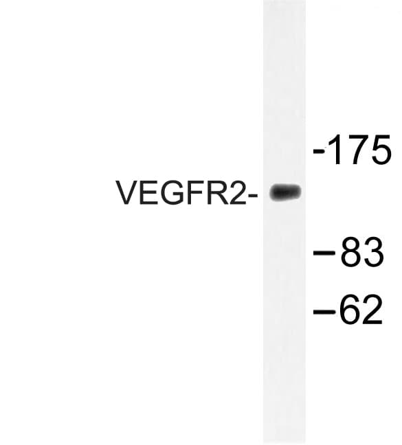 KDR / VEGFR2 / FLK1 Antibody (Asp1209)