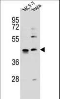 ZNF384 Antibody (aa531-559)