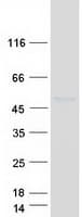 Human IL5RA / CD125 Protein (Recombinant Myc-DDK (Flag))