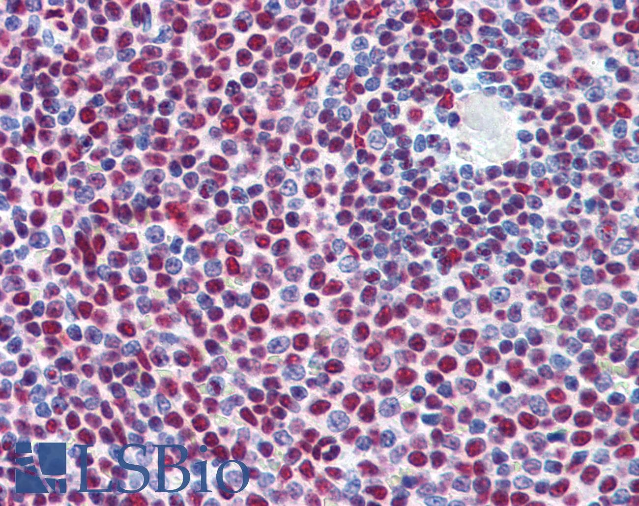 IHC-plus™ Polyclonal Goat anti-Human NF45 / ILF2 Antibody (aa355-367, IHC, WB)