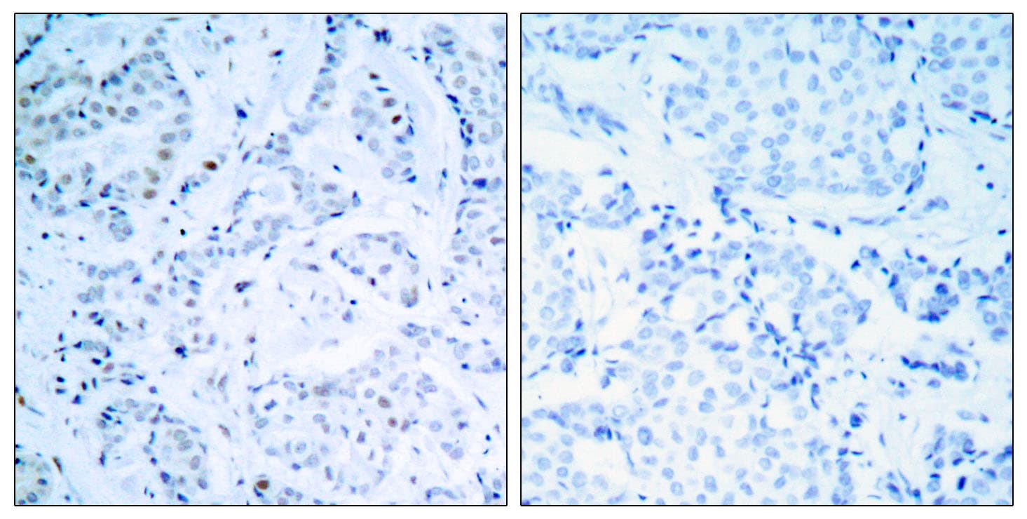 Polyclonal Rabbit anti-Human ER Alpha / Estrogen Receptor Antibody (aa81-130, IHC, WB)