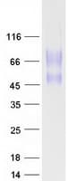 Human CD164 Protein (Recombinant Myc-DDK (Flag))