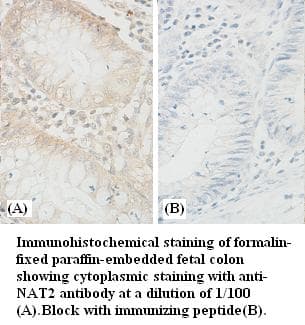 Polyclonal Rabbit anti-Human NAT2 Antibody (IHC)