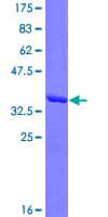 Human SERPINB3 Protein (Recombinant GST, N-terminus)