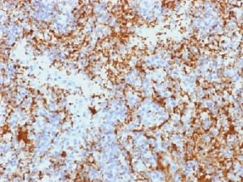 ITGB3 / Integrin Beta 3 / CD61 Antibody (clone Y2/51, Azide-free, BSA-free)