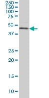 CSNK1G1 / CKI-Gamma 1 Antibody (clone 2E10)