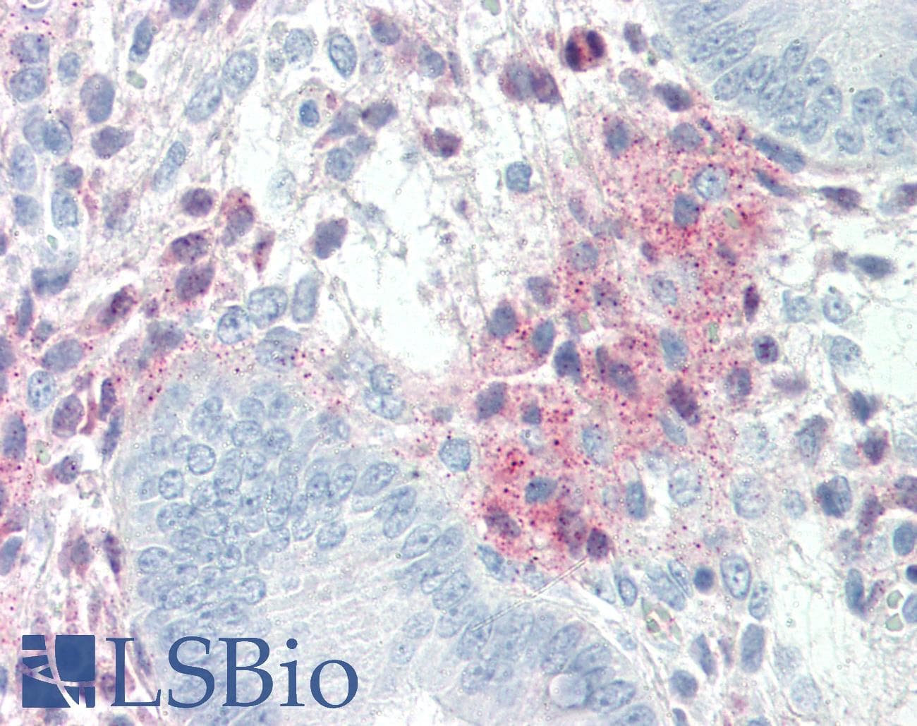 PathPlus™ SERPINF1 / PEDF Antibody (aa196-347)