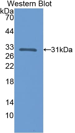 CALB1 / Calbindin Antibody (aa2-261, PE)