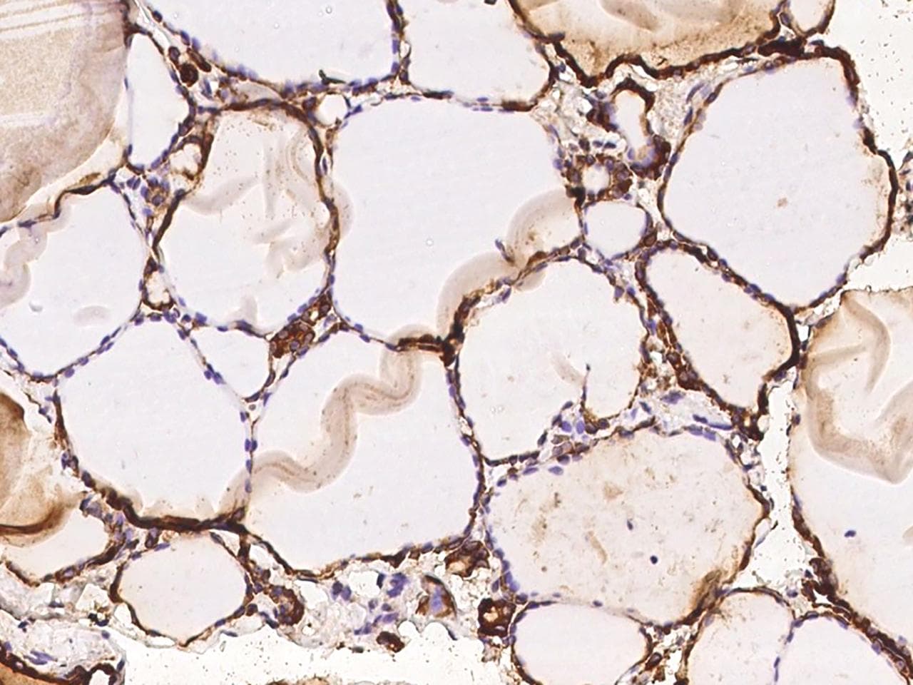 Polyclonal Rabbit anti-Human TPO / Thyroid Peroxidase Antibody (IHC)
