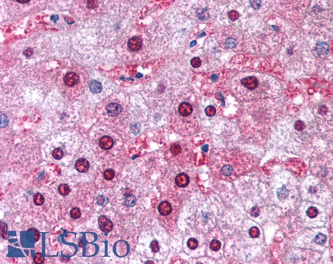 GSTM1 Antibody (aa31-80)